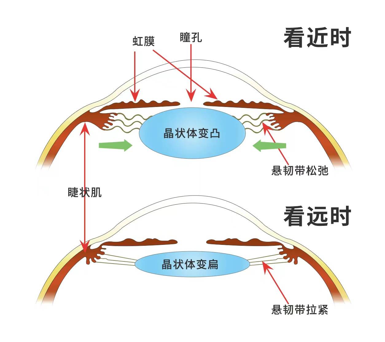 睫状肌收缩晶状体变化图片